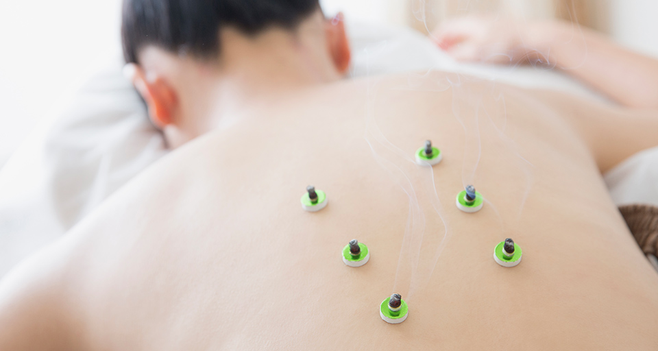 マスタープラン灸＋鍼(ごう鍼)＋シール鍼